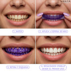 Tiras Blanqueadoras Dentales - VANTA